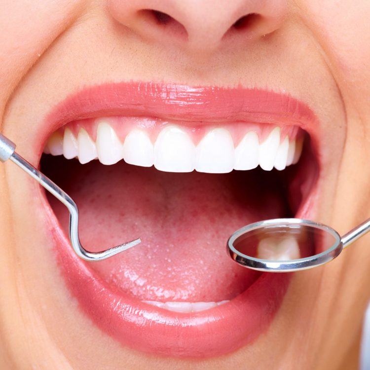 Improve-Your-Smile