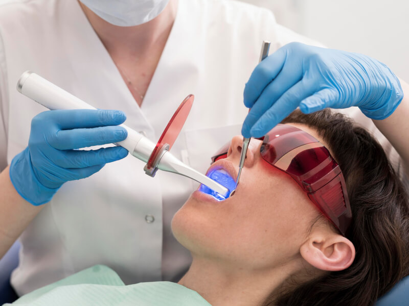 Professional Cleaning teeth image