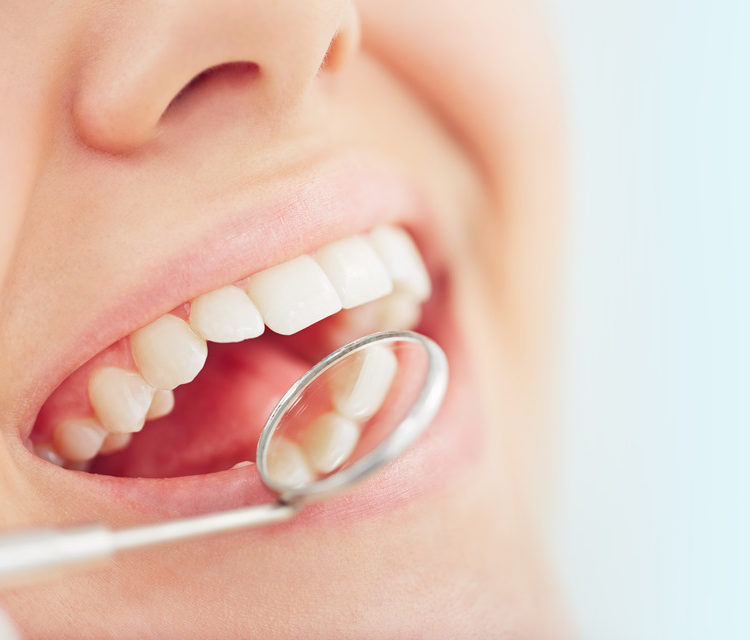 Dental checkup