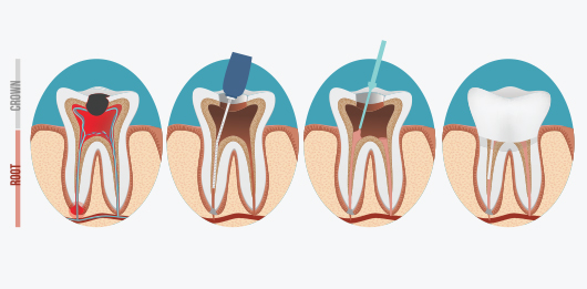 dental img